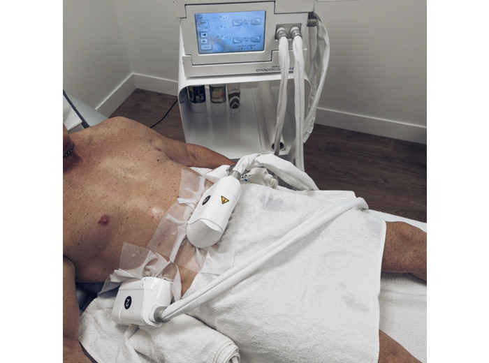 Cryolipolyse - 3 séances 2 zones