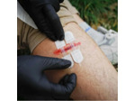 Rhino Rescue : kit de fermeture de plaies sans suture - TM & Outdoor