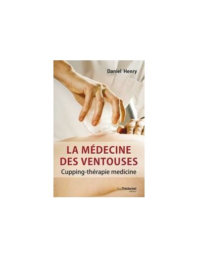 La médecine des ventouses