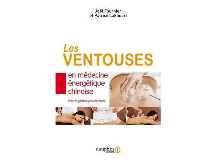 Ventouses en médecine énergétique chinoise - Pour 25 pathologies courantes