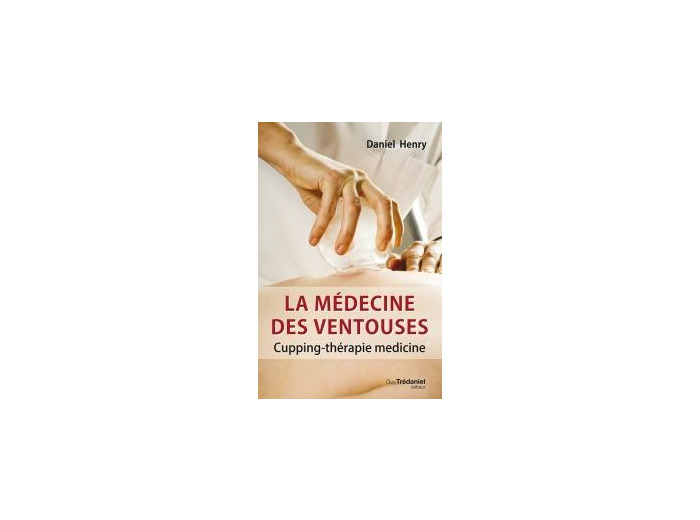 La médecine des ventouses